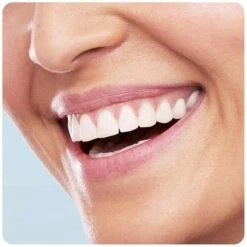 Oral B Oral-B Vitality 100 CrossAction Zwart - Elektrische Tandenborstel -Oral B 1200x1200 145